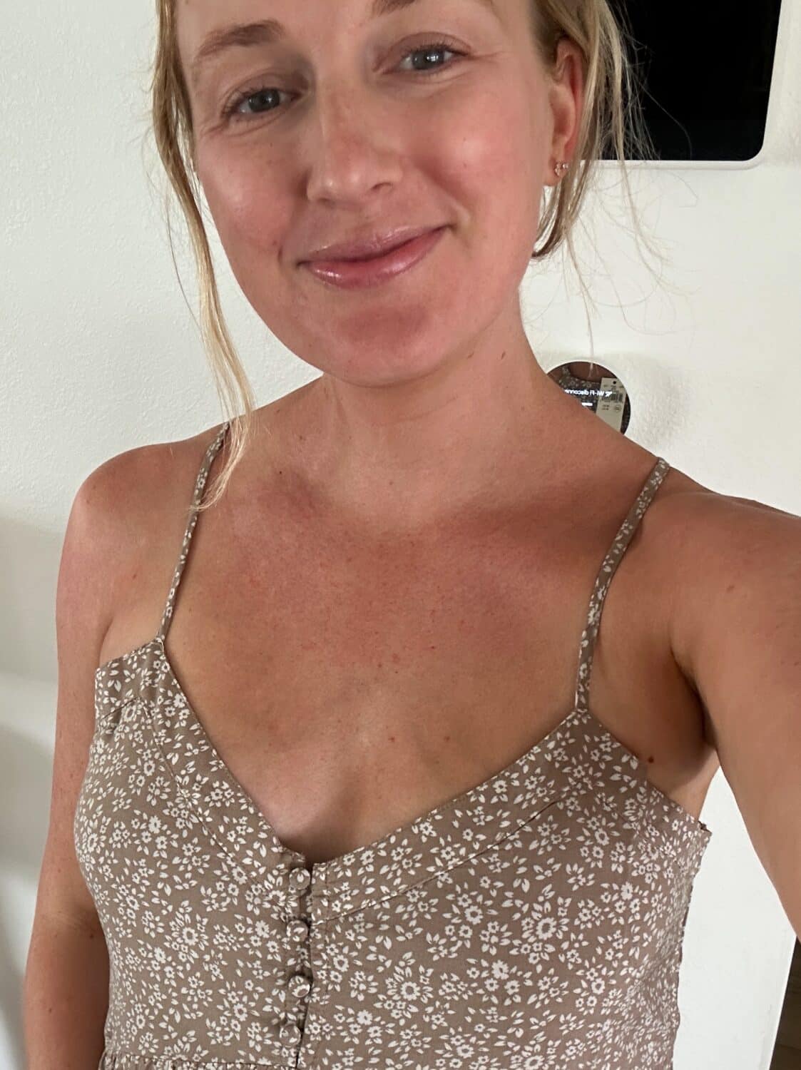 ruth nuss in a brown sundress for a red light mask review